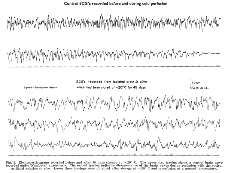 Ликбез по Крионике: простым языком на сложную тему - 9